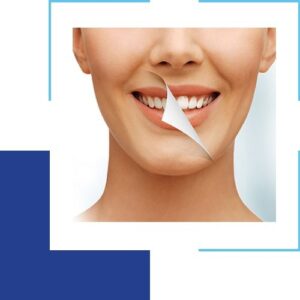 Tips to Maintain Your Teeth